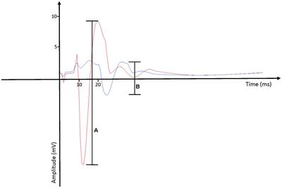 The Reliability of Neurological Measurement in the Vastus Medialis: Implications for Research and Practice